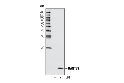  Image 6: Senescence Associated Secretory Phenotype (SASP) Antibody Sampler Kit