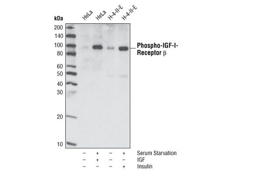  Image 2: Phospho-Insulin/IGF Receptor Antibody Sampler Kit