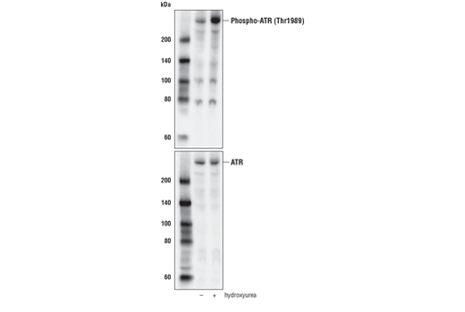 Western Blotting Image 1: Phospho-ATR (Thr1989) (D5K8W) Rabbit mAb