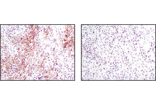 Immunohistochemistry Image 1: Phospho-Met (Tyr1234/1235) (D26) XP® Rabbit mAb