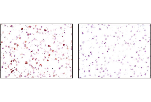 Immunohistochemistry Image 3: Phospho-Met (Tyr1234/1235) (D26) XP® Rabbit mAb