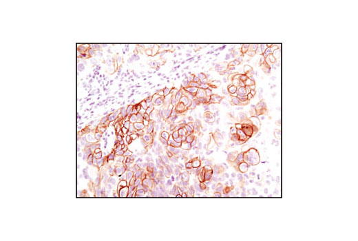 Immunohistochemistry Image 4: Phospho-Met (Tyr1234/1235) (D26) XP® Rabbit mAb