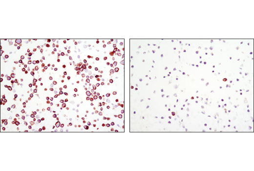 Immunohistochemistry Image 5: Phospho-Met (Tyr1234/1235) (D26) XP® Rabbit mAb