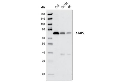 Western Blotting Image 1: c-IAP2 (58C7) Rabbit mAb