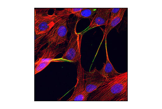 Immunofluorescence Image 1: α-Actinin Antibody