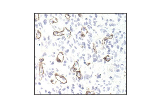  Image 25: Cancer Associated Fibroblast Marker Antibody Sampler Kit