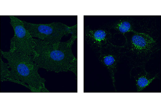  Image 38: Cancer Associated Fibroblast Marker Antibody Sampler Kit