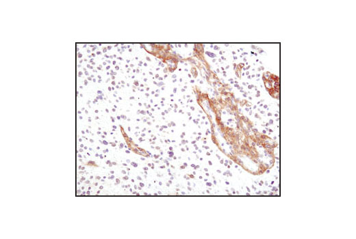  Image 20: Cancer Associated Fibroblast Marker Antibody Sampler Kit