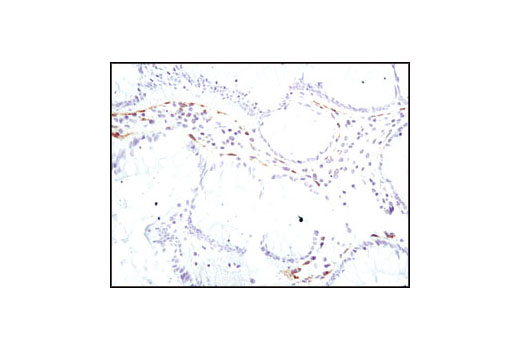  Image 26: Cancer Associated Fibroblast Marker Antibody Sampler Kit