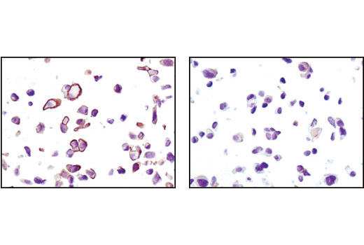 Immunohistochemistry Image 3: Phospho-Akt (Ser473) (D9E) XP® Rabbit mAb (BSA and Azide Free)