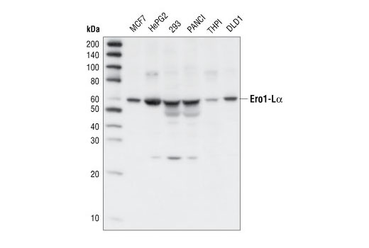  Image 5: ER Stress Antibody Sampler Kit