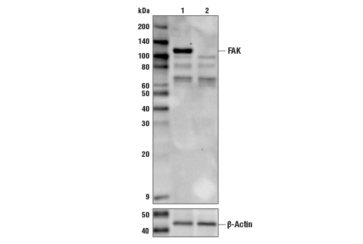 Western Blotting Image 1: FAK Antibody