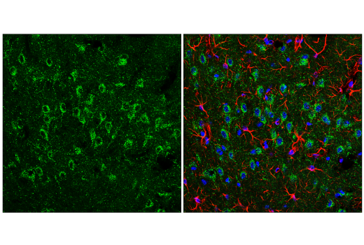  Image 4: Organelle Localization IF Antibody Sampler Kit