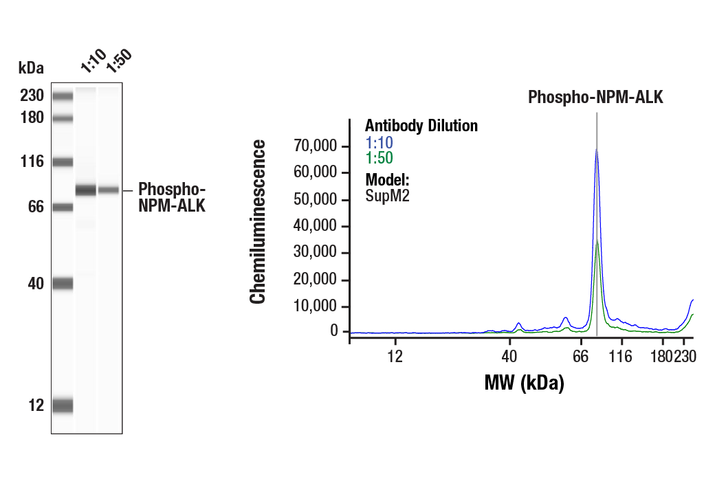 Western Blotting Image 2: Phospho-ALK (Tyr1604) Antibody