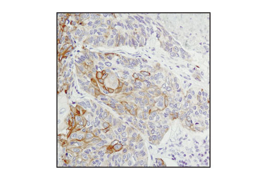  Image 37: IFN (Type I/III) Signaling Pathway Antibody Sampler Kit