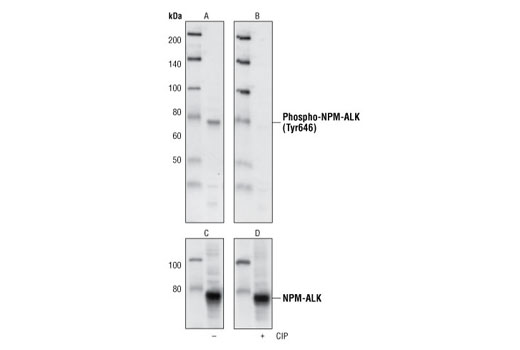 Western Blotting Image 1: Phospho-ALK (Tyr1586) (3B4) Rabbit mAb