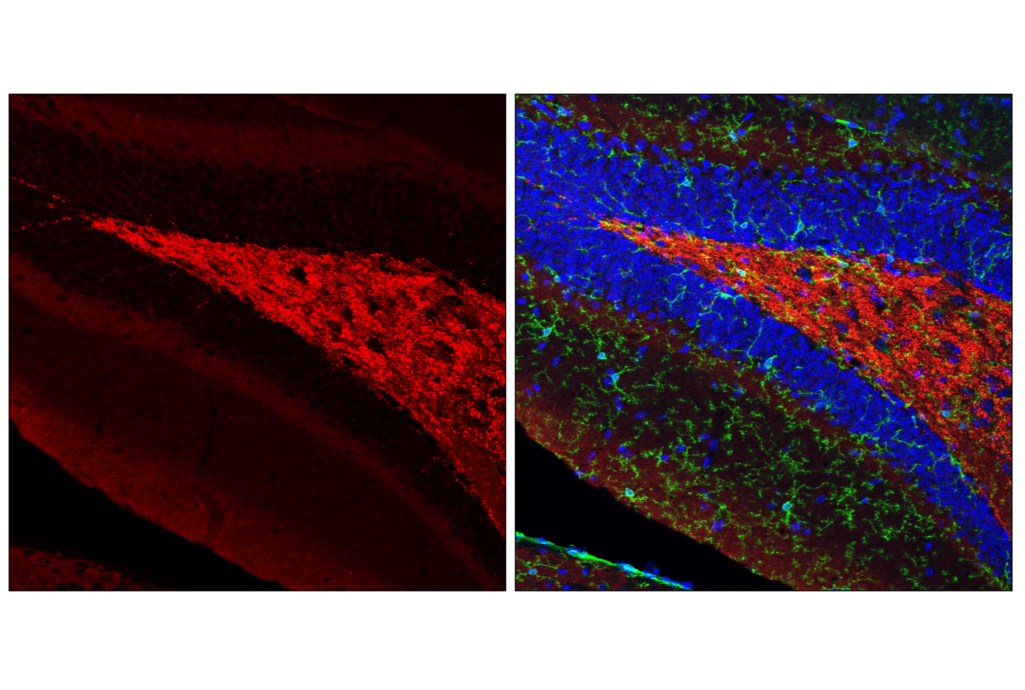 Immunofluorescence Image 1: α-Synuclein (E4U2F) XP® Rabbit mAb (Alexa Fluor® 647 Conjugate)