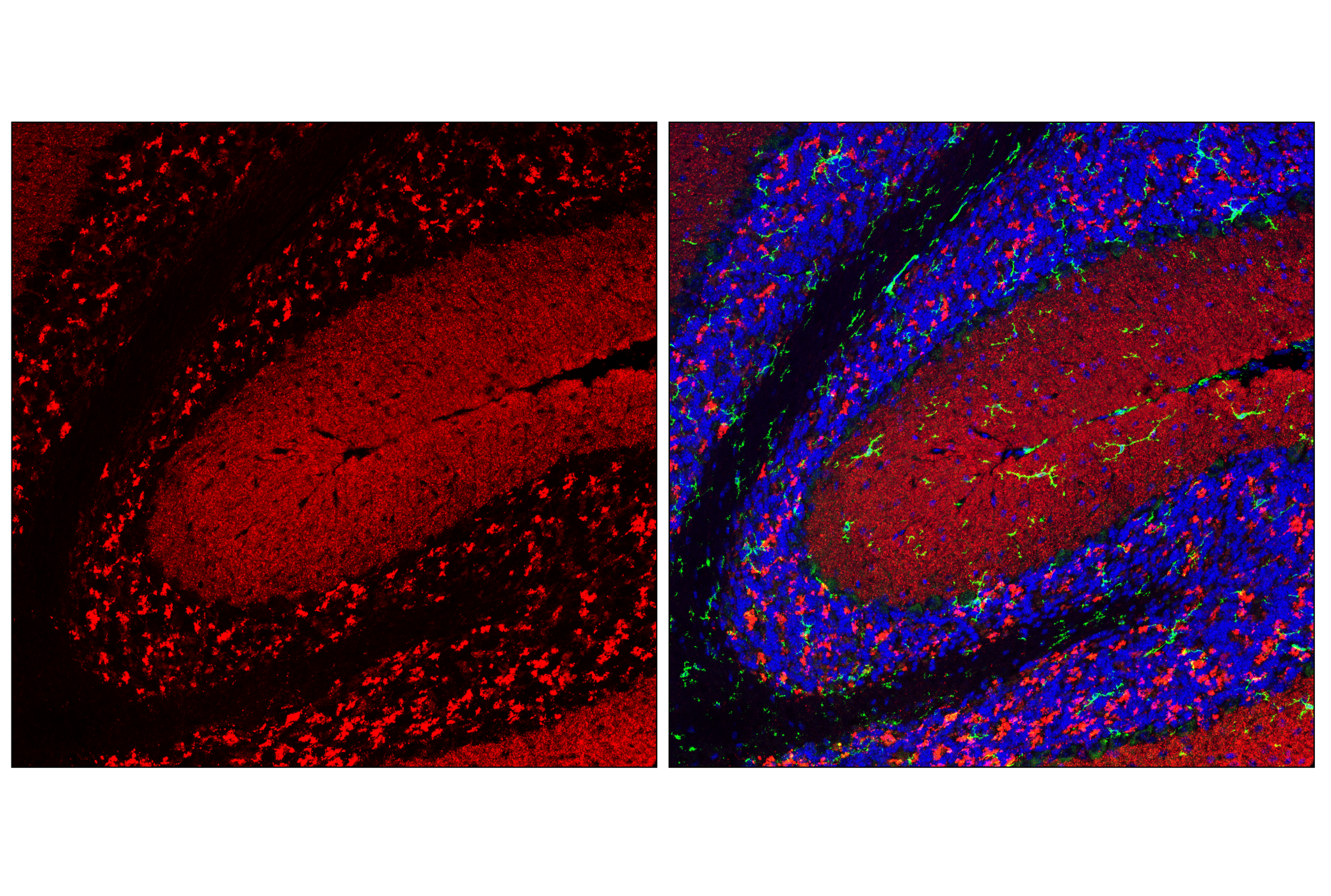 Immunofluorescence Image 2: α-Synuclein (E4U2F) XP® Rabbit mAb (Alexa Fluor® 647 Conjugate)