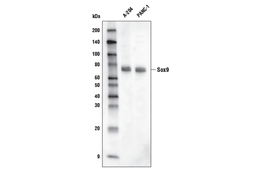 Western Blotting Image 1: Sox9 (D8G8H) Rabbit mAb (Biotinylated)