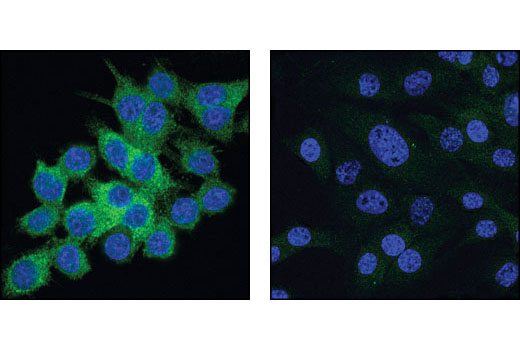 Image 16: Microglia LPS-Related Module Antibody Sampler Kit