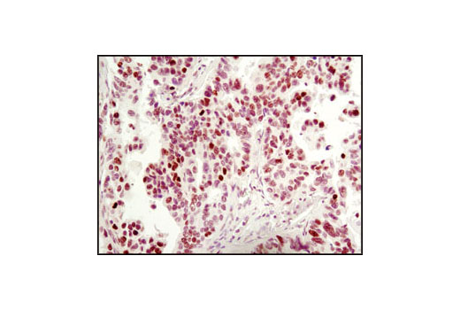 Immunohistochemistry Image 1: MeCP2 (D4F3) XP® Rabbit mAb