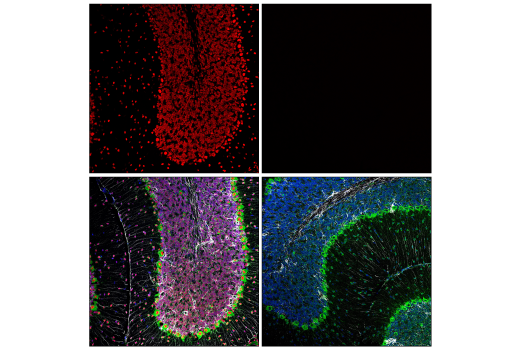 Immunofluorescence Image 1: MeCP2 (D4F3) XP® Rabbit mAb