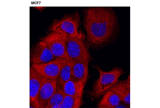 Immunofluorescence Image 1: Pan-Keratin (C11) Mouse mAb (Alexa Fluor® 555 Conjugate)