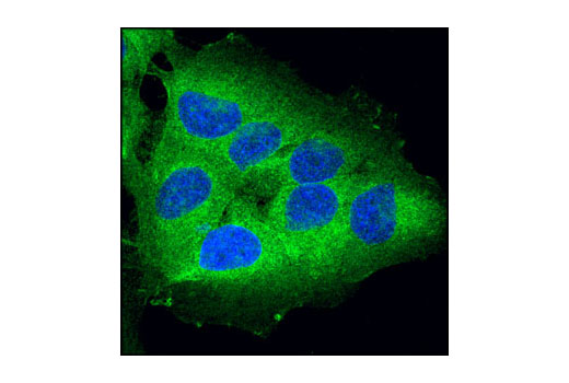 Immunofluorescence Image 1: RIP (D94C12) XP® Rabbit mAb (BSA and Azide Free)