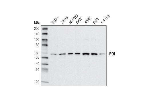  Image 7: ER Stress Antibody Sampler Kit