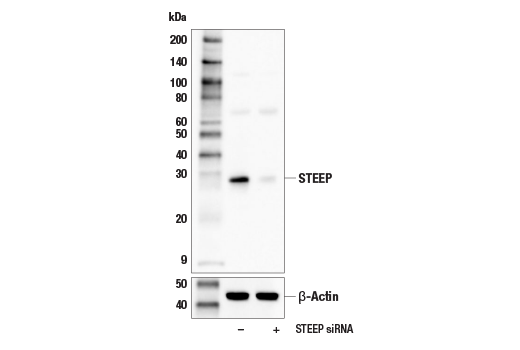 Western Blotting Image 2: STEEP Antibody