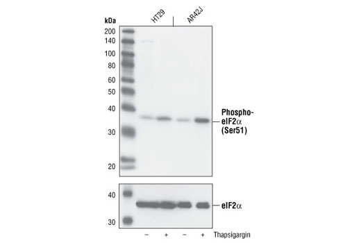 Western Blotting Image 1: Phospho-eIF2α (Ser51) (119A11) Rabbit mAb