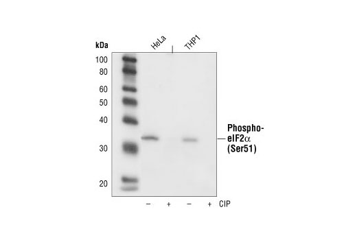 Western Blotting Image 2: Phospho-eIF2α (Ser51) (119A11) Rabbit mAb