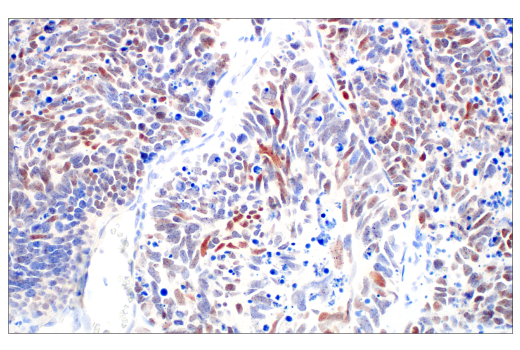  Image 14: Small Cell Lung Cancer Biomarker Antibody Sampler Kit