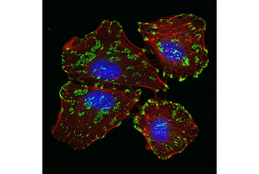  Image 11: Integrin Antibody Sampler Kit