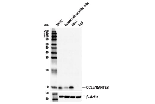 Western Blotting Image 1: CCL5/RANTES (E9S2K) Rabbit mAb