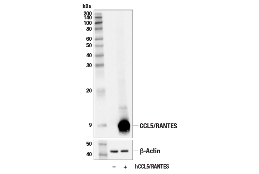 Western Blotting Image 2: CCL5/RANTES (E9S2K) Rabbit mAb