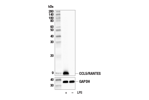 Western Blotting Image 3: CCL5/RANTES (E9S2K) Rabbit mAb