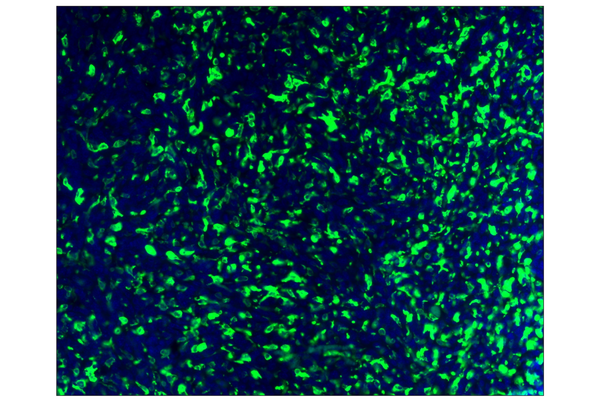 Immunohistochemistry Image 1: CD206/MRC1 (E6T5J) XP® Rabbit mAb (Alexa Fluor® 488 Conjugate)