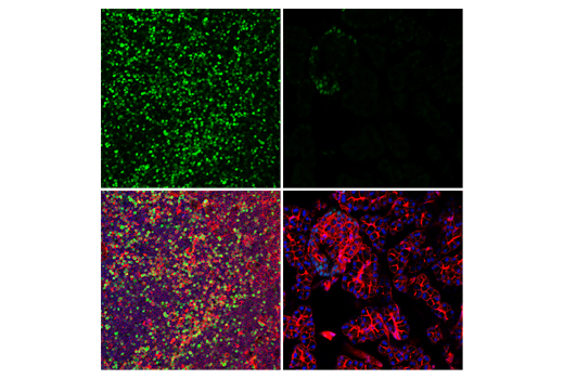  Image 46: Human Exhausted T Cell Antibody Sampler Kit