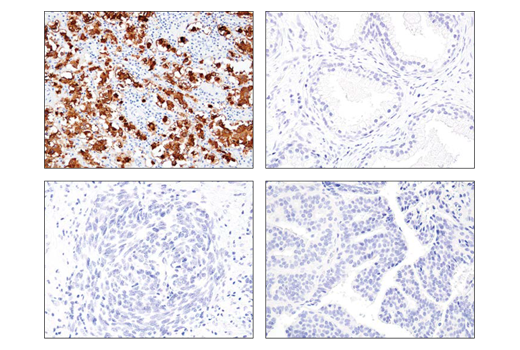  Image 12: StemLight™ iPS Cell Reprogramming Antibody Kit