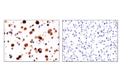  Image 16: StemLight™ iPS Cell Reprogramming Antibody Kit