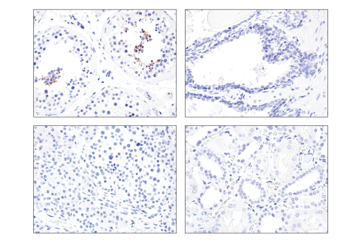  Image 20: StemLight™ iPS Cell Reprogramming Antibody Kit