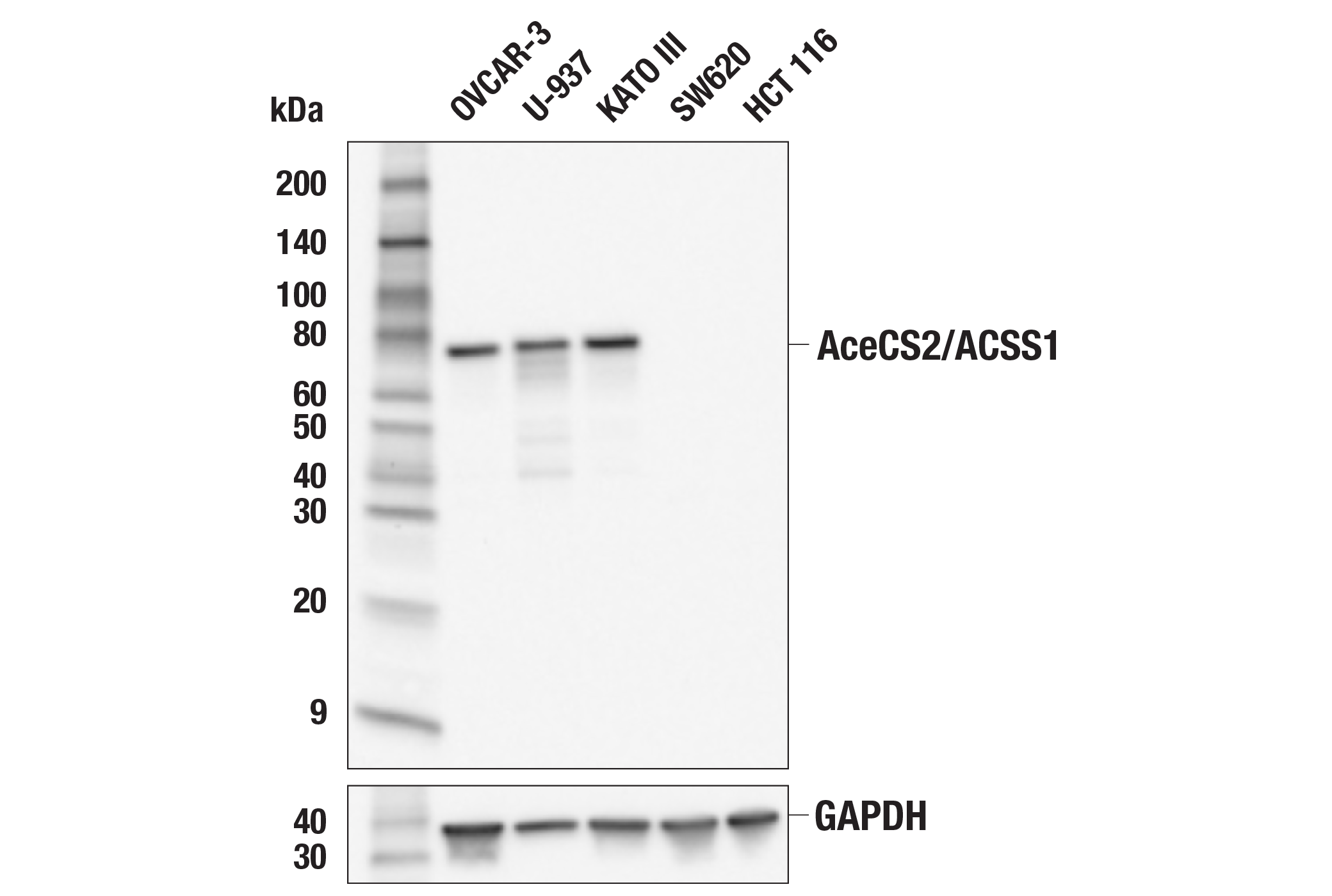 Western Blotting Image 1: AceCS2/ACSS1 (E6T5E) Rabbit mAb