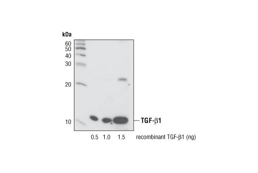  Image 5: TGF-β Fibrosis Pathway Antibody Sampler Kit