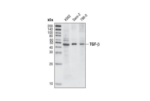  Image 24: TGF-β Fibrosis Pathway Antibody Sampler Kit