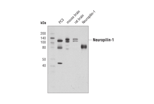  Image 2: SARS-CoV-2 Virus-Host Interaction Antibody Sampler Kit