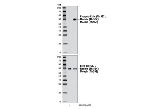  Image 17: Microglia LPS-Related Module Antibody Sampler Kit