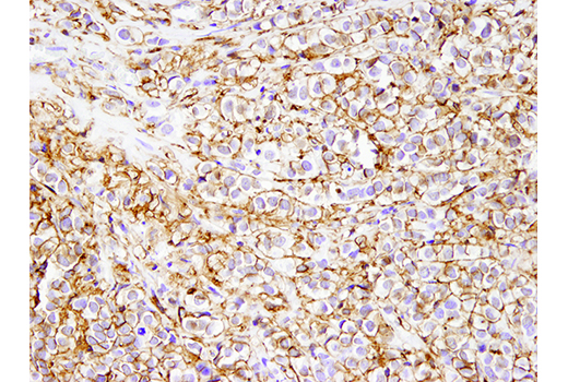  Image 25: Microglia LPS-Related Module Antibody Sampler Kit