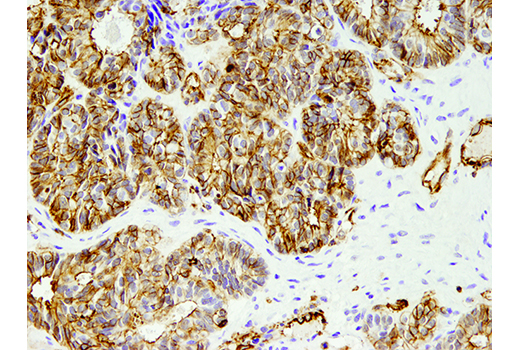  Image 32: Microglia LPS-Related Module Antibody Sampler Kit
