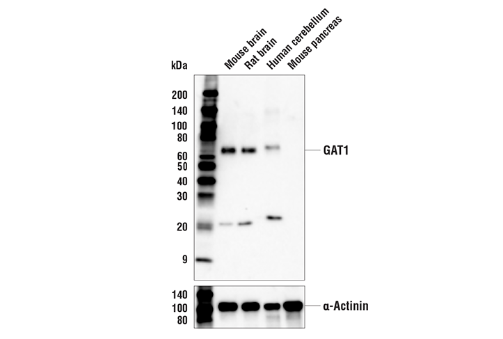 Western Blotting Image 1: GAT1 (E7J1B) Rabbit mAb